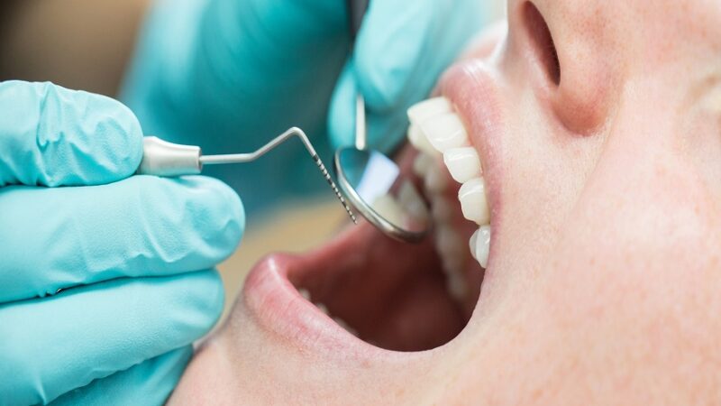 dentures, partial dentures,