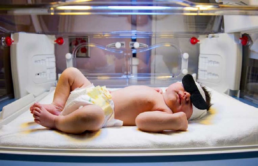 Everything you need to know about the jaundice and children